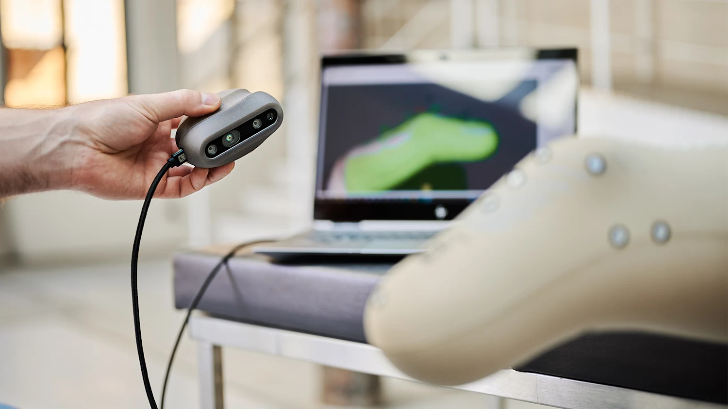 iFab EasyScan — handheld 3D scanning system capturing a residual limb